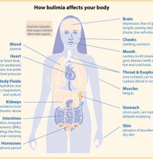Om bulimi